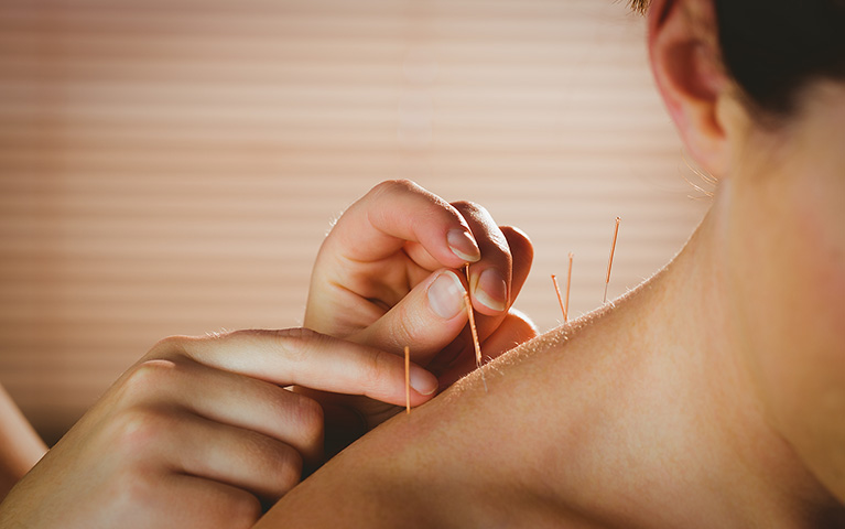 Practice Medical Acupuncture at AcuMed