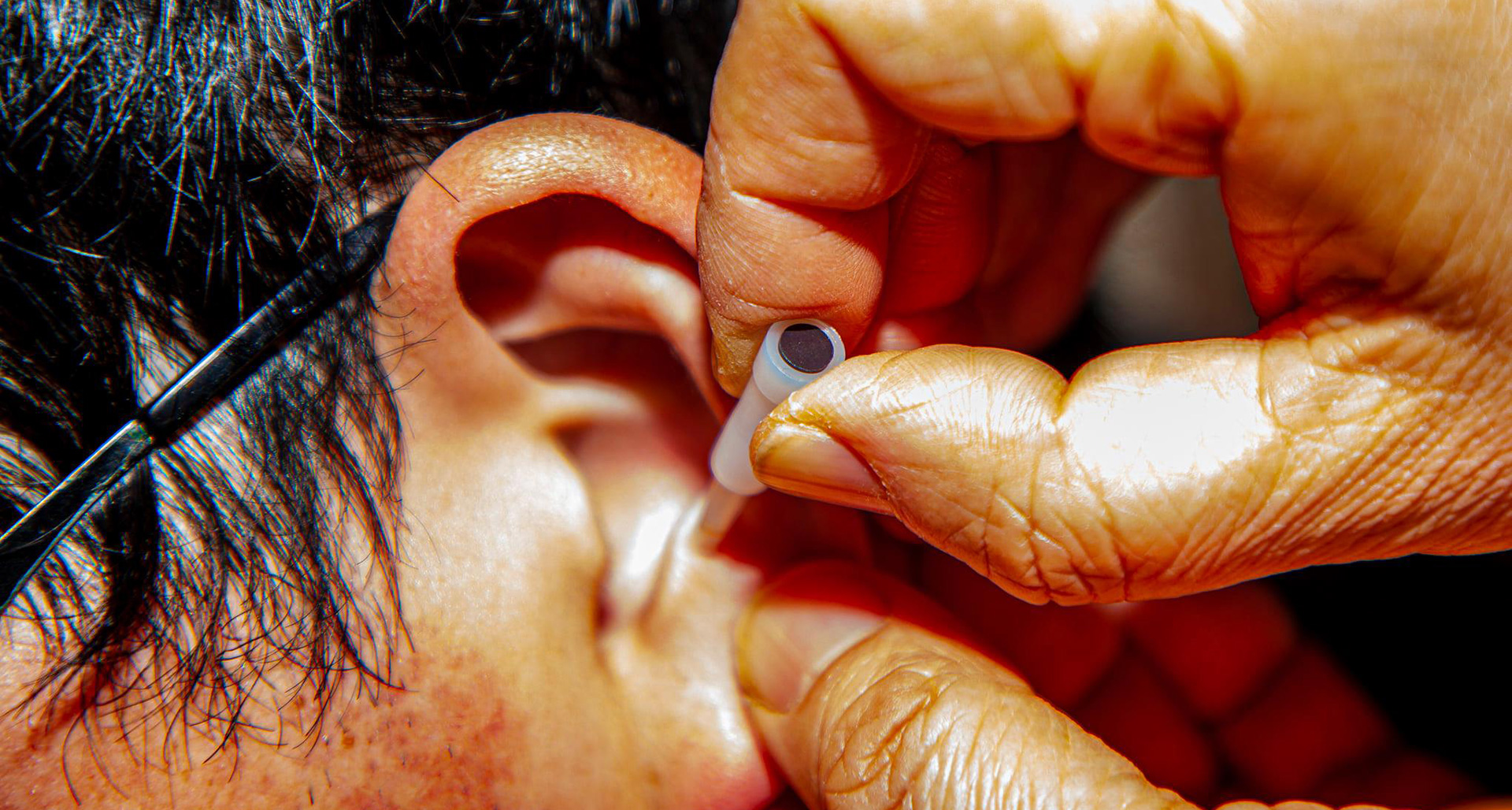 effective method to treat pain without medications learn Battlefield