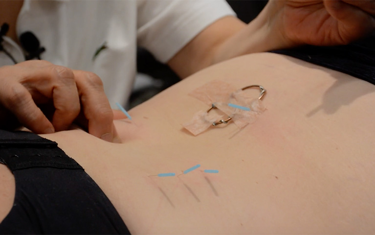 Palpation Based Acupuncture Course